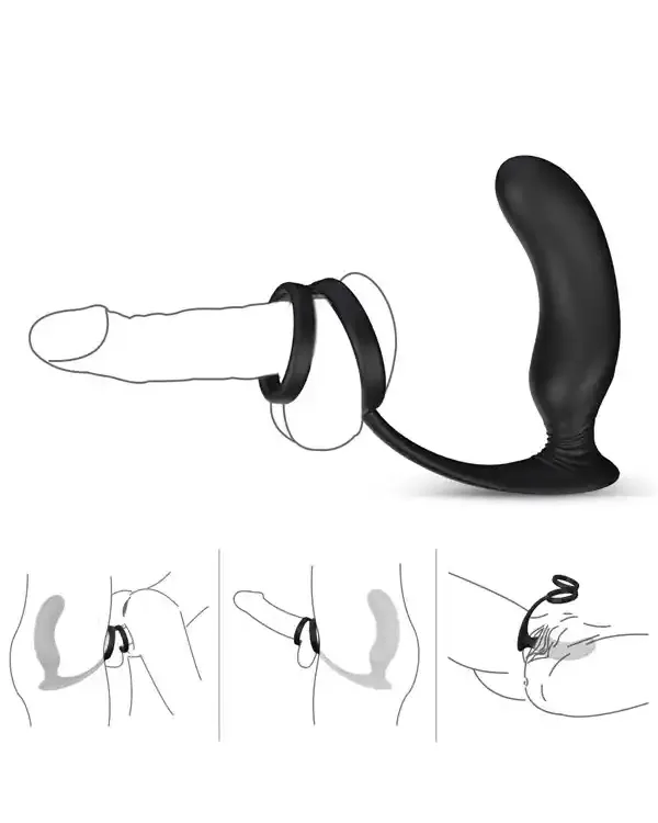 NOXXX Halo Penis Halkalı Prostat ve Şarjlı Anal Masaj Vibratörü